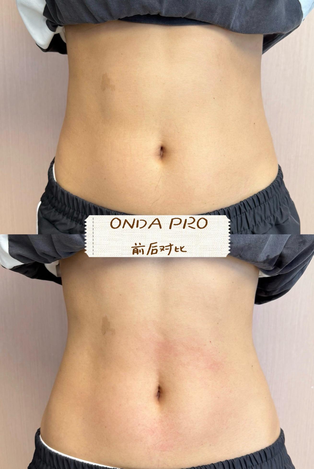 ONDA PRO case image